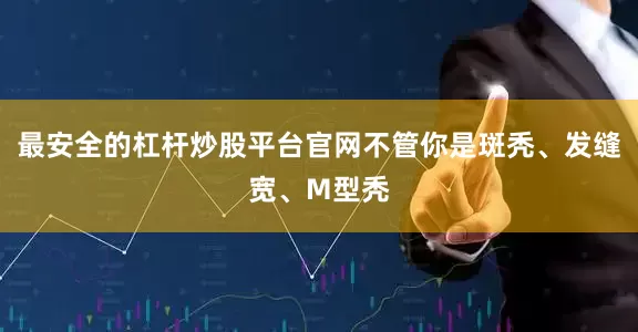 最安全的杠杆炒股平台官网不管你是斑秃、发缝宽、M型秃
